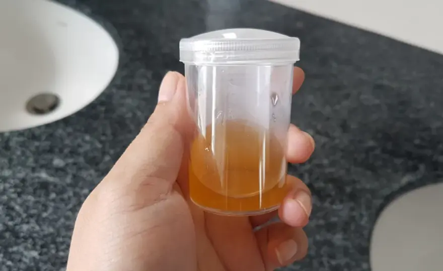 Fosforany bezpostaciowe w moczu psa i kota - Co oznaczają?